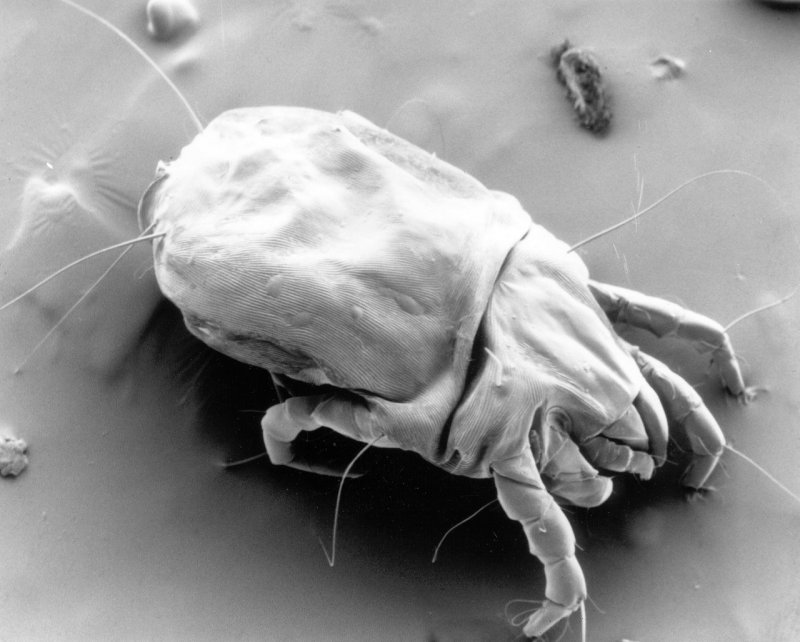 Клещ Dermatophagoides pteronyssinus IGE