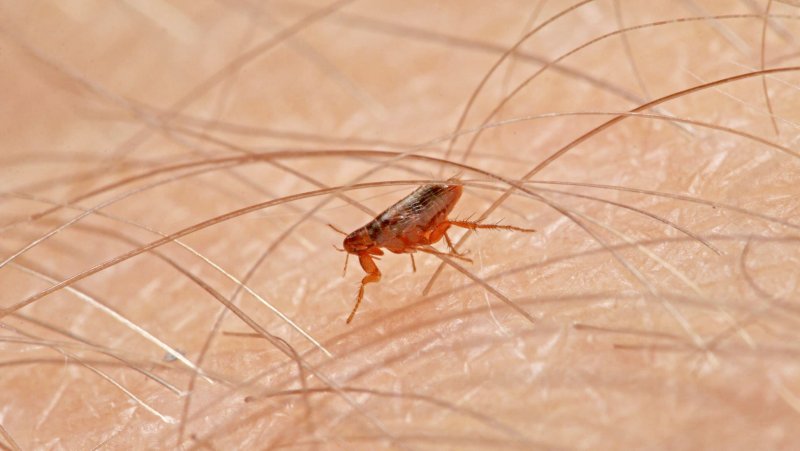What does Bedbug bites look like treatment of bites