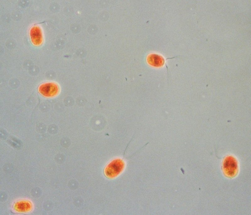 Дуналиелла (Dunaliella Salina)
