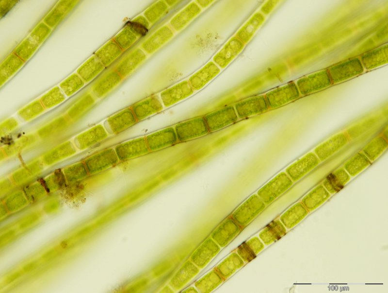 Spirogyra водоросль