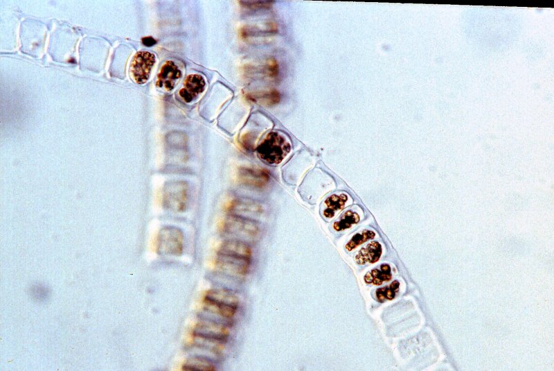 Улотрикс опоясанный (Ulothrix zonata).