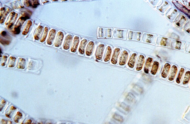 Ulotrix SP.