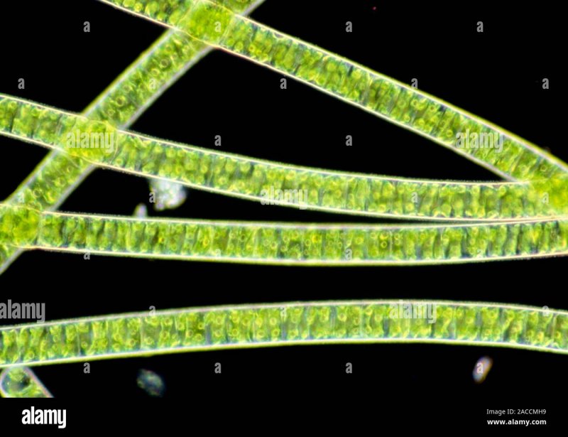 Spirogyra SP