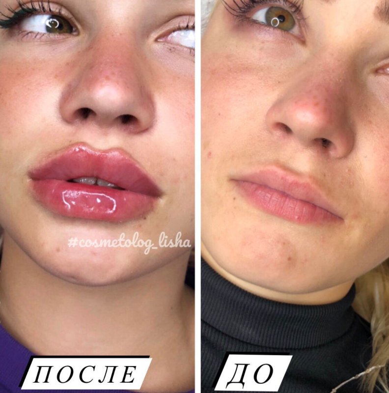 Стилаж Stylage l